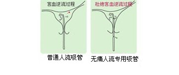 普通人流便宜 你准备好了吗?