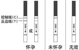 点击咨询：和田打胎前要做哪些检查?