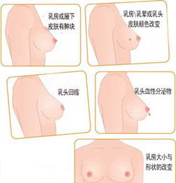 胸部发育过小是怎么回事，乳房过小能治疗吗?