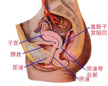 陇南妇科专家详解如何治疗盆腔脓肿