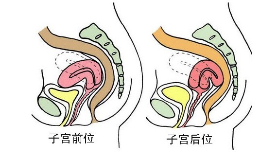 子宫前位是什么意思