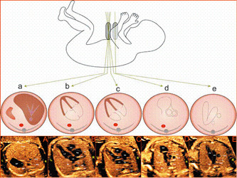 胎儿超声心动图_陇南妇产医院